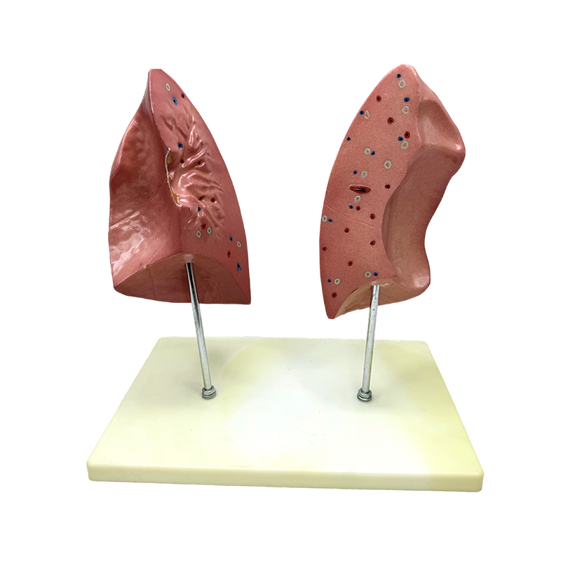 Biologisch model onderwijzen, linker- en rechterlongmodel, menselijke ingewanden, anatomisch longmodel